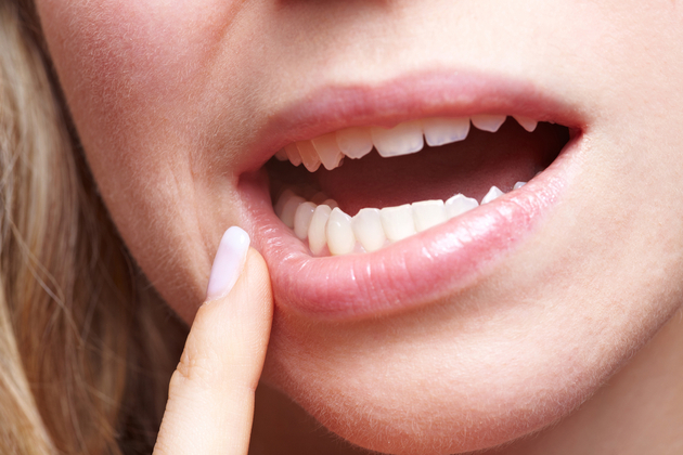歯並びが悪いのは歯が大きすぎるからではなく 顎が小さすぎるから Newsphere